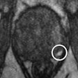 2020 05 27 16 55 1679 2020 27 05 Mri Insider Prostate Mri Dce