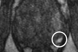 2020 05 27 16 55 1679 2020 27 05 Mri Insider Prostate Mri Dce