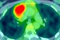 2018 03 19 15 16 7892 2018 03 19 Ukraine Thumbjpg