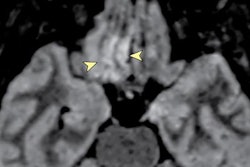 2020 05 29 16 30 0844 2020 05 29 Jama Fig 1 20200529163332