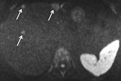 2020 06 01 17 22 0139 2020 06 02 Ecr2020 Abdominal