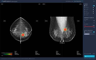 The Lunit Insight MMG artificial intelligence software. Image courtesy of Lunit.