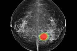 2020 06 02 23 17 2693 2020 06 02 Lunit Insight Mmg 20200602234846