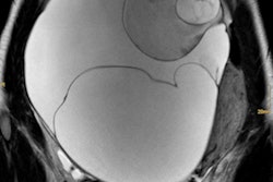2020 06 03 18 34 5656 2020 06 03 Ovarian Editorial Figure1 A