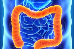 2020 06 10 18 58 3520 Colon Intestine 400