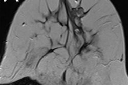 2020 06 12 16 00 9316 2020 06 15 Kaiser Score Figure 5 20200612164927