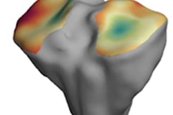 2020 06 17 15 59 6909 2020 06 09 Mri Bone 2 20200617150436