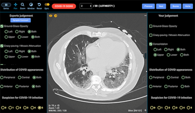 The module includes real COVID-19 CT images at full resolution. Here the interface reveals a true COVID-19 case. All images courtesy of Prof. Patrick Brennan.