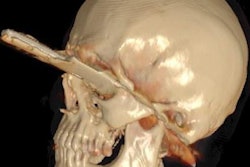 2020 06 30 15 23 7169 2020 06 30 Boeven Figure 5 20200630154717