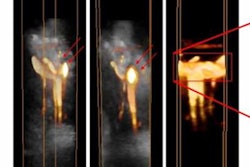 2020 06 30 20 31 0988 2020 07 01 3 D Ucda Fig3 20200630202428