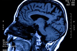 2020 07 09 15 10 1888 Mri Head 400