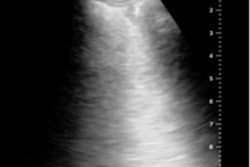 2020 07 22 17 08 7863 2020 07 21 Ct Us Comparison 2 20200722175436