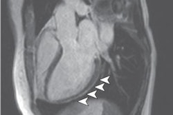 2020 07 27 17 18 1641 2020 07 27 Puntmann 20200727173640