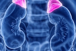 2020 07 28 16 51 6860 Adrenal Gland 400