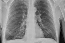 2020 08 03 21 18 4648 2020 08 04 Brady Fig 14 20200803211932 20200803221429