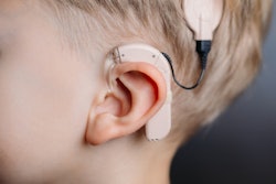 2020 08 05 18 50 2785 Cochlear Implant2 400