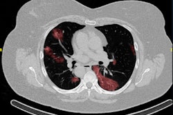 2020 08 17 20 47 7521 Geplakte Afbeelding 400