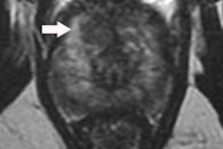 2018 10 15 20 04 2505 2018 10 16 Jfr Irm Multiparametrique Thumb