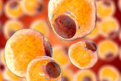 2020 10 01 16 13 9876 Fat Tissue Adipocytes 400