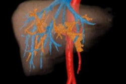 2020 10 01 21 28 9402 2020 10 01 Ho Liver Fig6 20201001212449