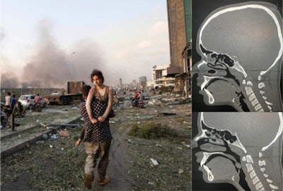 Beirut is facing extremely difficult times right now. Images courtesy of the Journées Francophones de Radiologie.