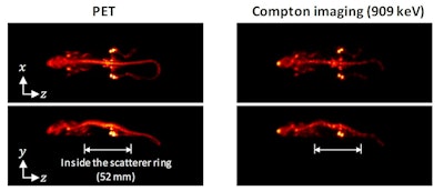 Reconstructed PET (left) and Compton (right) images of a mouse injected with Zr-89 oxalate.