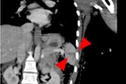 2020 10 09 15 24 4699 2020 10 09 Eur Rad Matoori Case2 20201009152407