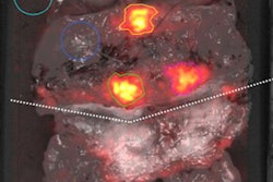 2020 10 12 17 13 8441 2020 10 08 Cerenkov 20201012175532