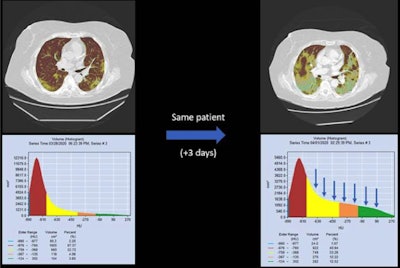 Artificial intelligence and automatic reporting tools have proved their value during the pandemic.