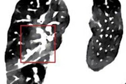 2020 10 22 23 39 9195 2020 10 22 Ajr Spectral Ct 1 20201022233727