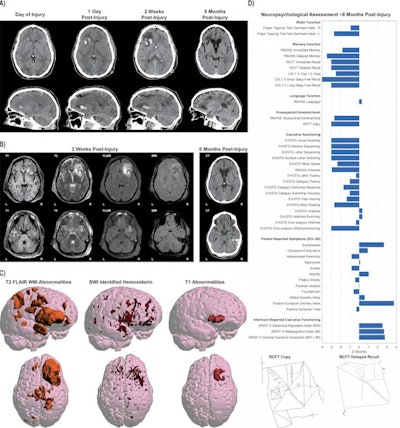 Illustration shows complexity of the data obtained from a single patient with moderate/severe traumatic brain injury. Different imaging approaches and techniques have their own unique sensitivity in assessing different aspects of neuroanatomy and neuropathology. What can be seen on images also changes with time since injury. Image courtesy of Olsen et al, Brain Imaging and Behavior, 2020.