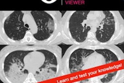 2020 10 28 19 11 2555 2020 10 29 I Phone Covid Quiz Ame 20201028195042