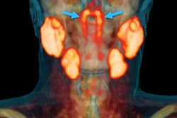 2020 10 30 01 11 4426 2020 10 30 Psma Pet Figure1 A