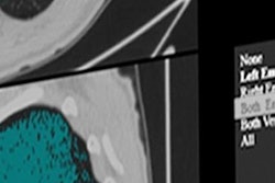 2019 12 02 19 42 3533 Fovia Ai X Stream Ai Cockpit 20191202194637