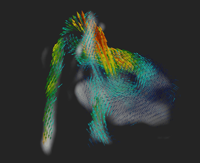 A 4D flow cine loop showing pulsatile blood flow through the aorta during the cardiac cycle. Loop courtesy of Nature Communications.