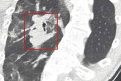 2020 10 22 23 39 9195 2020 10 22 Ajr Spectral Ct 1 20201130163810