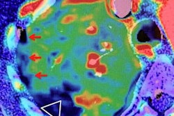 2020 10 30 22 21 0171 2020 11 02 Oudkerk Figure1 20201030225920