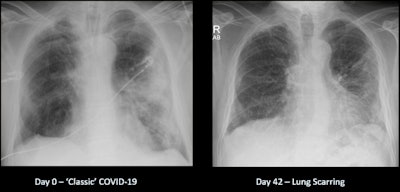 Recovery from COVID-19 can be a long road.