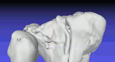 Region of interest segmented using MeshLab software. Image shows segments of the tibial and fibula bones and multifragmentar fracture of the tibia, dorsal side of the bones. All images courtesy of Dr. Mirela Juković.