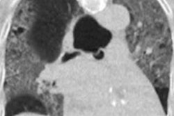 2020 11 19 23 24 8294 11 19 Chest Ct Covid Dutch Case1 20201119235506