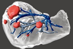 2020 12 01 17 34 7219 2020 12 01 Portugal Intrahepatic Masses 400