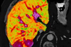 2020 12 03 20 38 2340 2020 12 03 Perspectum Hepatica 20201203204021