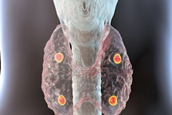 2020 12 15 18 06 1545 Parathyroid Glands 400