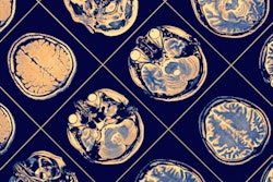 2020 02 20 22 51 4152 Mri Brain 400