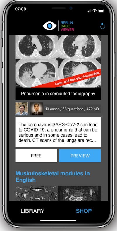 Users can scroll through the full CT dataset per case and access the clinical history available before deciding on diagnosis. Image courtesy of Dr. Kay-Geert Hermann.