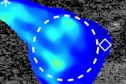 2021 01 15 01 09 5942 2021 01 15 Shear Wave Imaging Vocal Tract 400