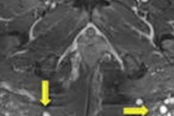 2021 01 15 17 46 6422 2021 01 14 Case2 Buttocks 20210115203500