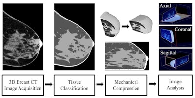 A flow chart demonstrating how the authors moved from capturing the initial breast CT images to analyzing fibroglandular tissue distribution of compressed breasts. Image published in Medical Physics on January 16.