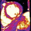 2021 01 25 16 25 5925 2021 01 22 3 D Cardiac Mri 20210125165018