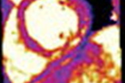 2021 01 25 16 25 5925 2021 01 22 3 D Cardiac Mri 20210125165018